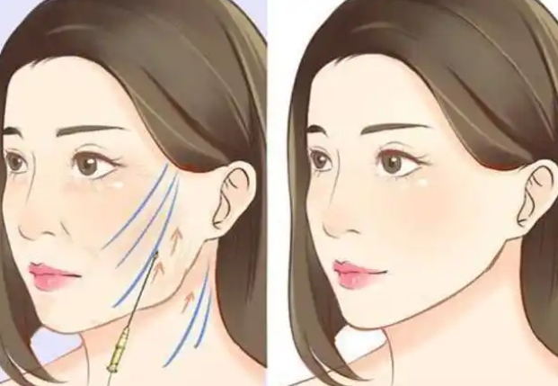 鄭州臉部饅化修復(fù)哪家強(qiáng)