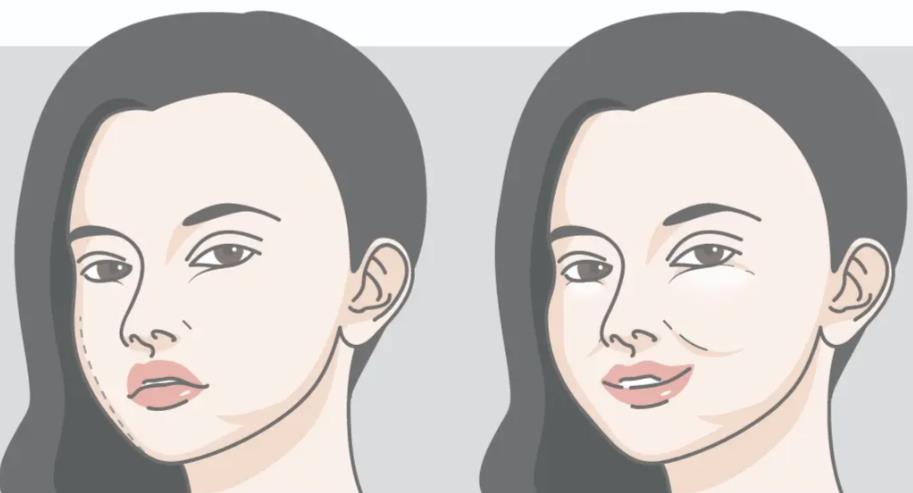 张立彬和黎星哪个取生长因子更好？技术稳沟通细，就是价格小贵