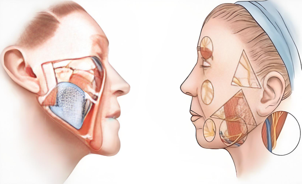 上海趙鵬筋膜懸吊