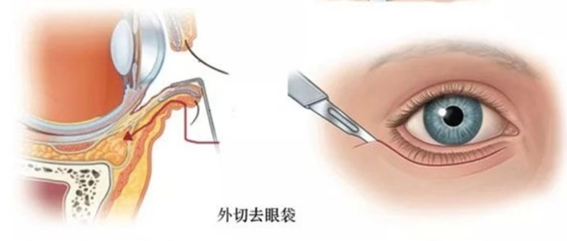 北京晶美醫(yī)療美容技術項目及價格