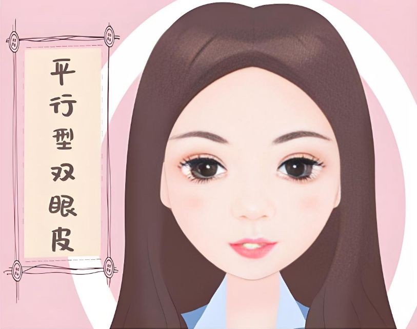 譚敏峰醫(yī)生做雙眼皮www.66ub.cn