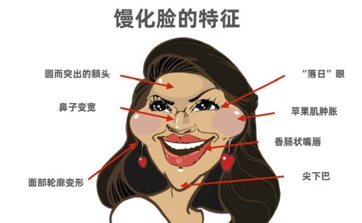 張本軍跟吳貞躍修復(fù)饅化臉誰厲害