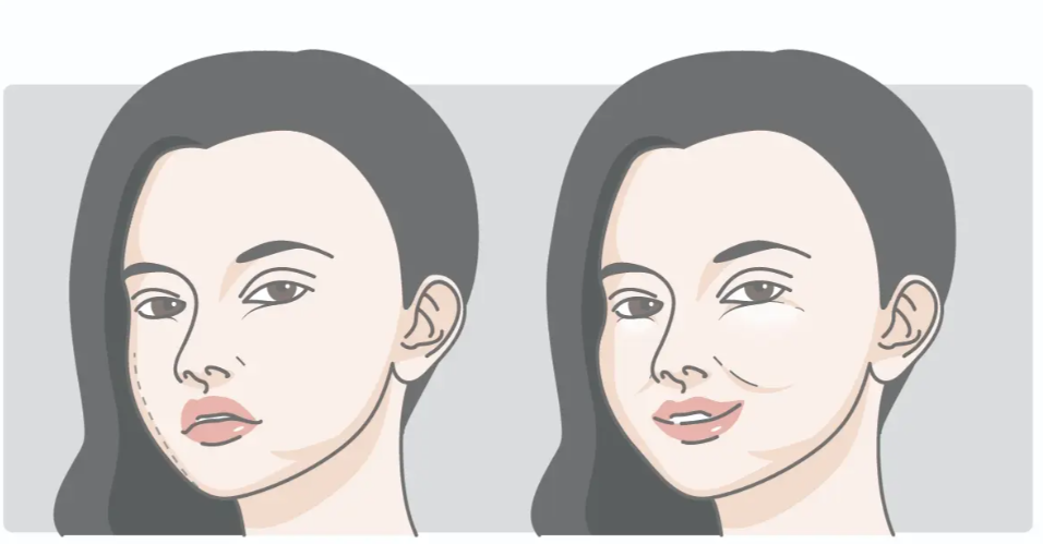 張本軍跟吳貞躍修復(fù)饅化臉誰了得：醫(yī)生背景與資質(zhì)對比