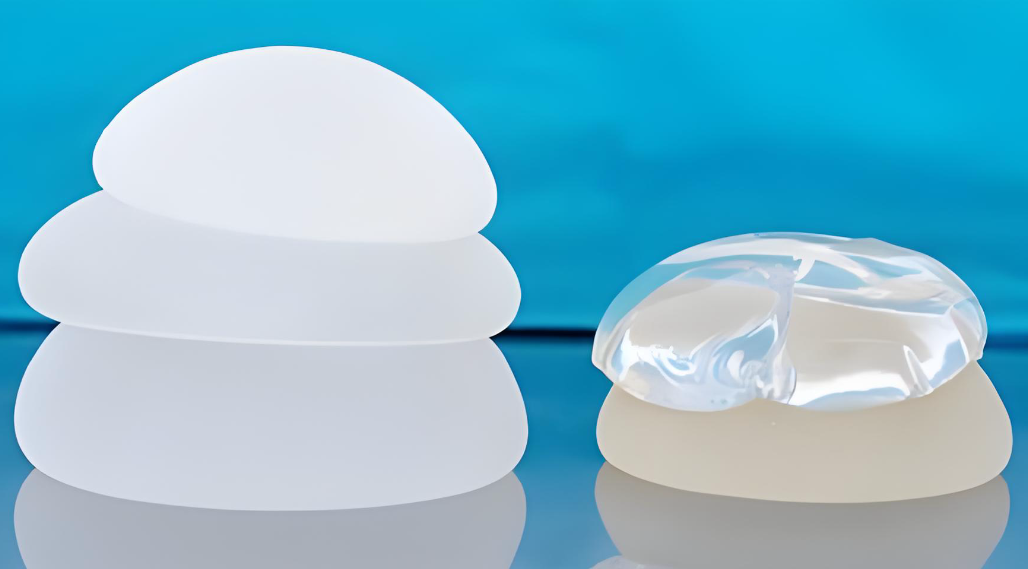 艾斯美假体怎么样www.8682.cc