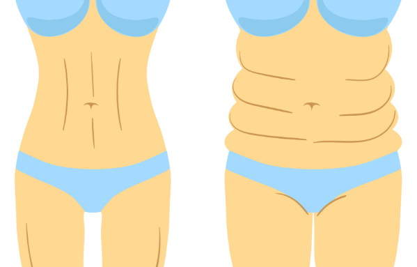 鄭州楊森醫(yī)生吸脂在哪個醫(yī)院