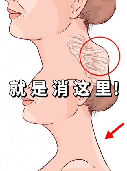 广州李方伟医生富贵包费用