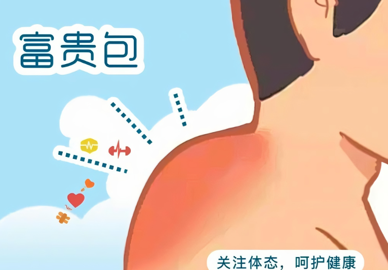 广州李方伟医生费用一般几万