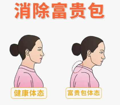 广州李方伟富贵包费用