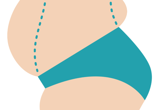 西安藝星的竇璽院長吸脂保守嗎？