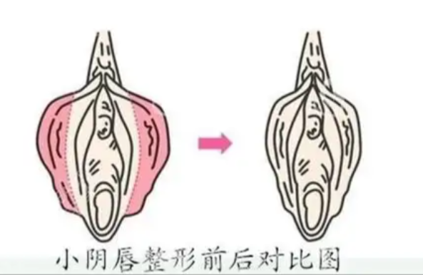 郑州私密整形有几家正规医院