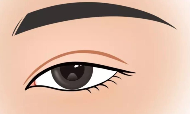 上海管果双眼皮真实评价