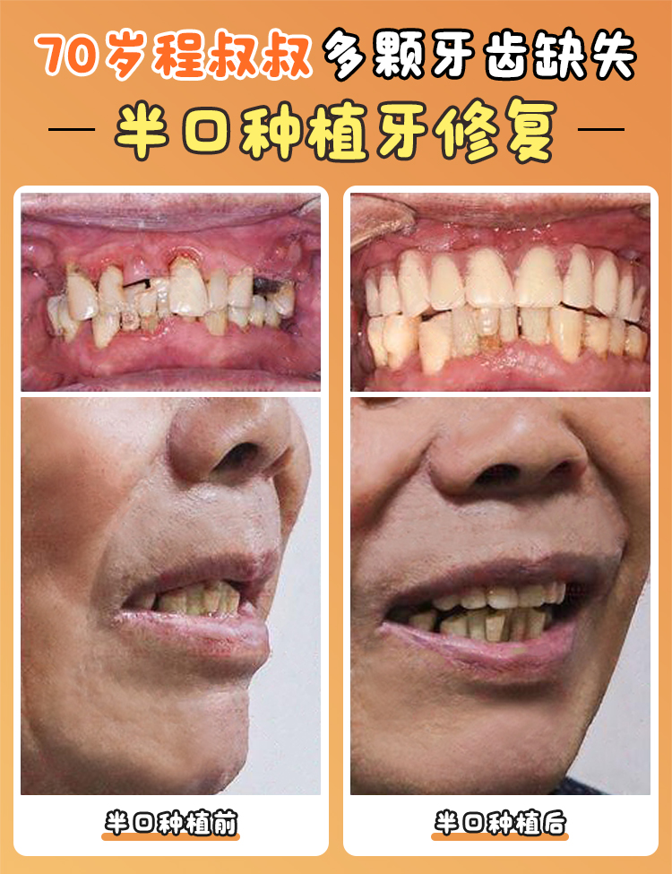 三、杭州亮貝美口腔醫(yī)院蔣賢軍 醫(yī)生簡(jiǎn)介