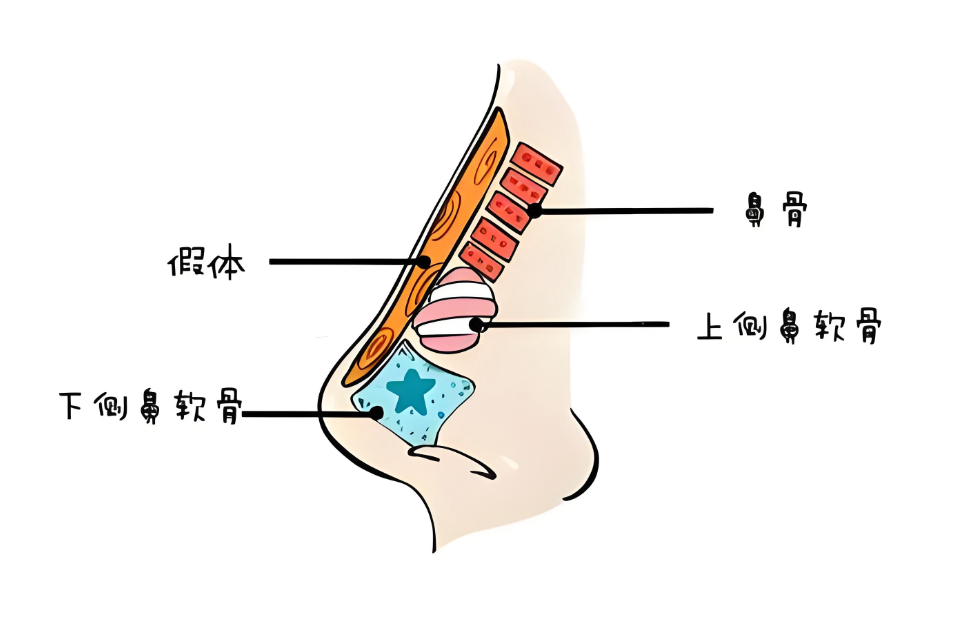 上海娜美王旭东做鼻子怎么样