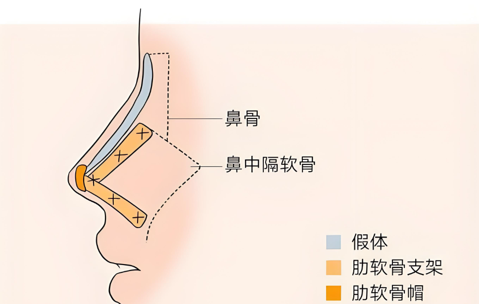 上海娜美王旭东做鼻子好不好www.8682.cc