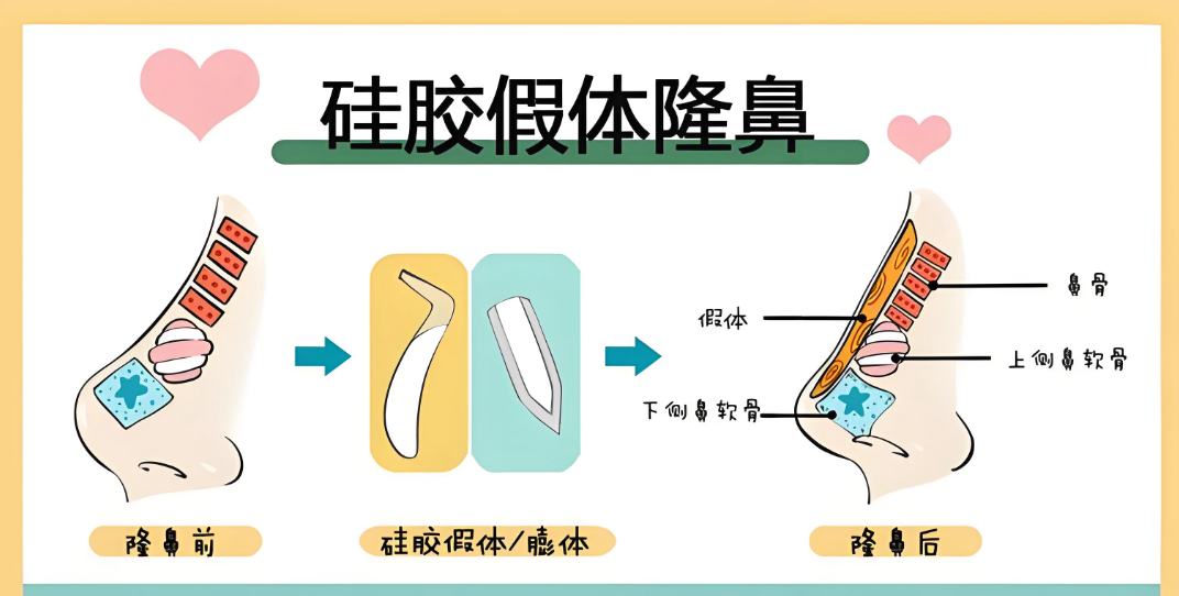 上海王旭东做鼻子怎么样