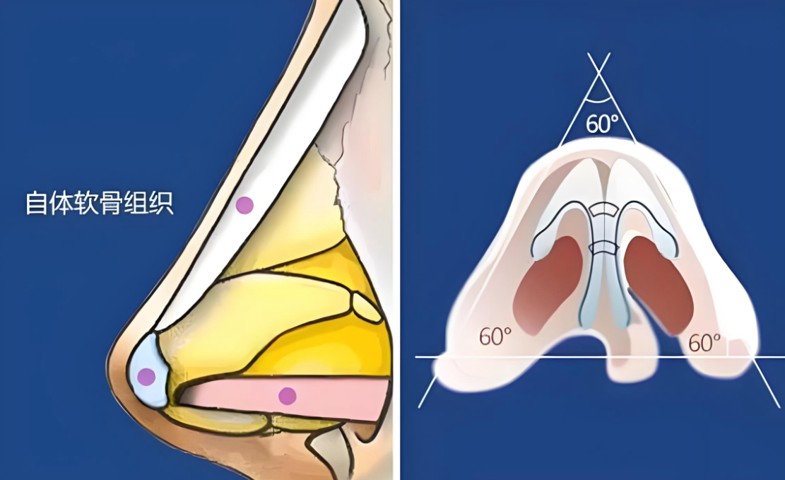 上海王旭东做鼻子好不好www.8682.cc