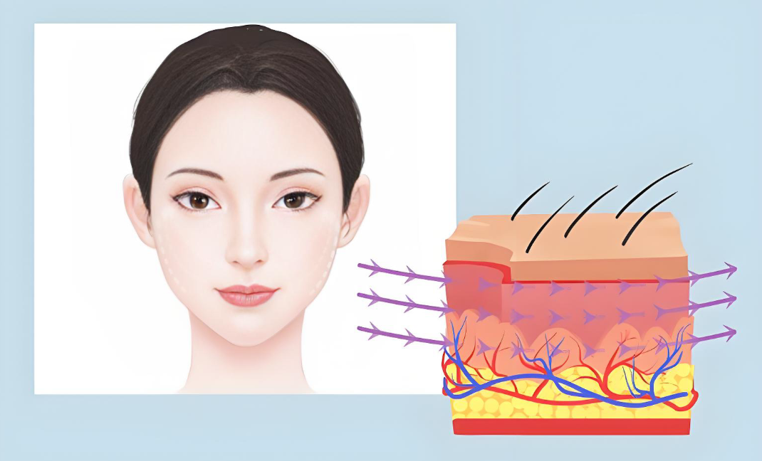 上海吕医生面部提升面部三件套究竟好在哪？从几个真人实例来分析他的手法，有三个比较打动我的亮点！