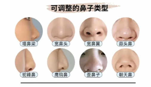 上海王旭东隆鼻恢复快吗？术后7天消肿经验分享，附真实实例对比