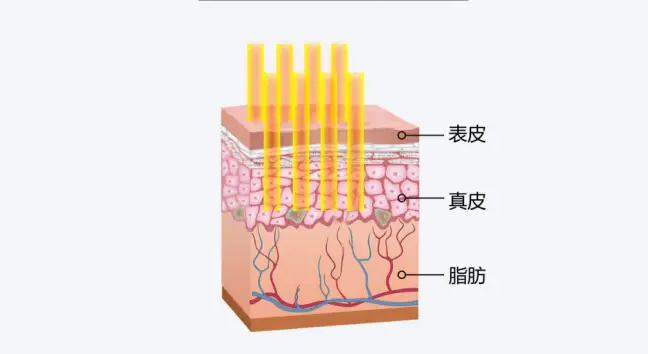 韩国cnp皮肤科评价不错
