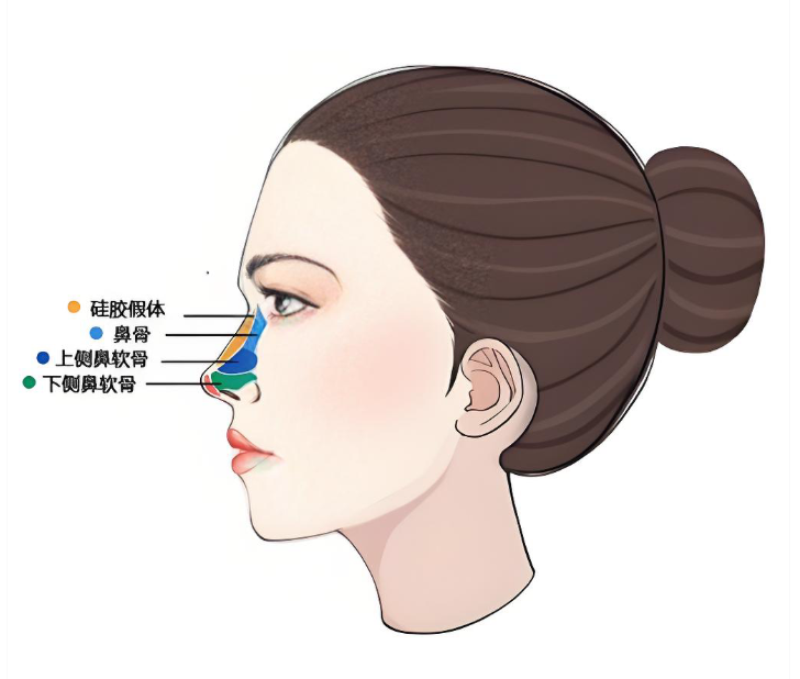 张辉医生的赫本鼻整形手术有哪些优势
