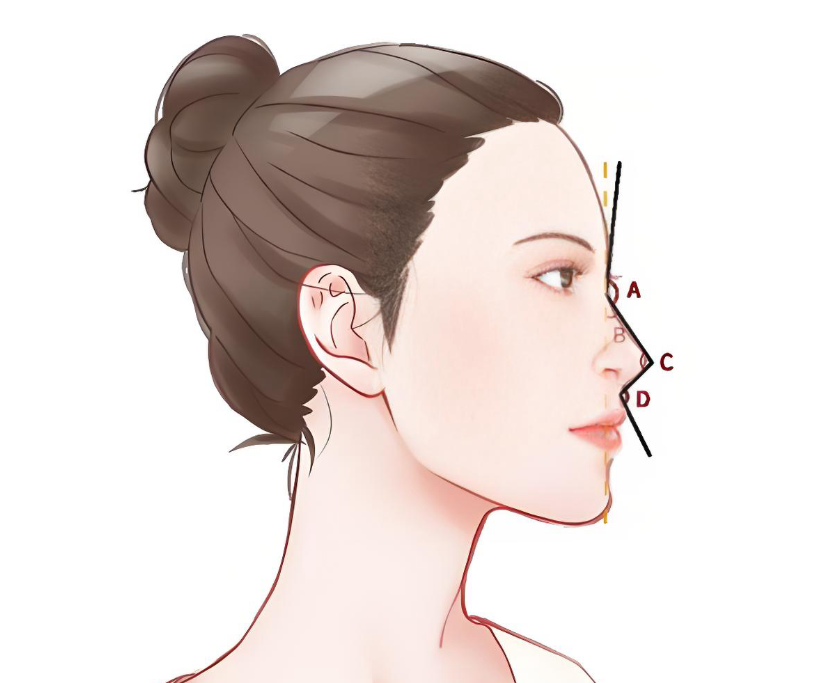 张辉赫本鼻整形手术www.8682.cc