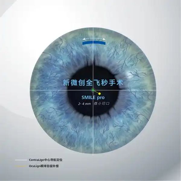 2025龙岩爱尔眼科医院收费价目表