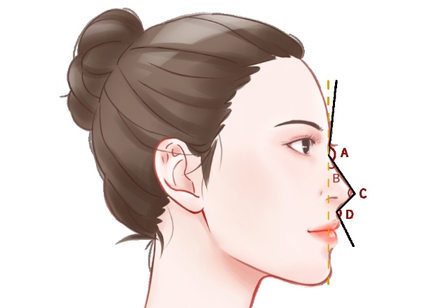 深圳陈桂飞隆鼻技术好不好