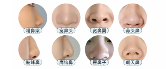 长沙肋骨鼻做的好的医生有哪些