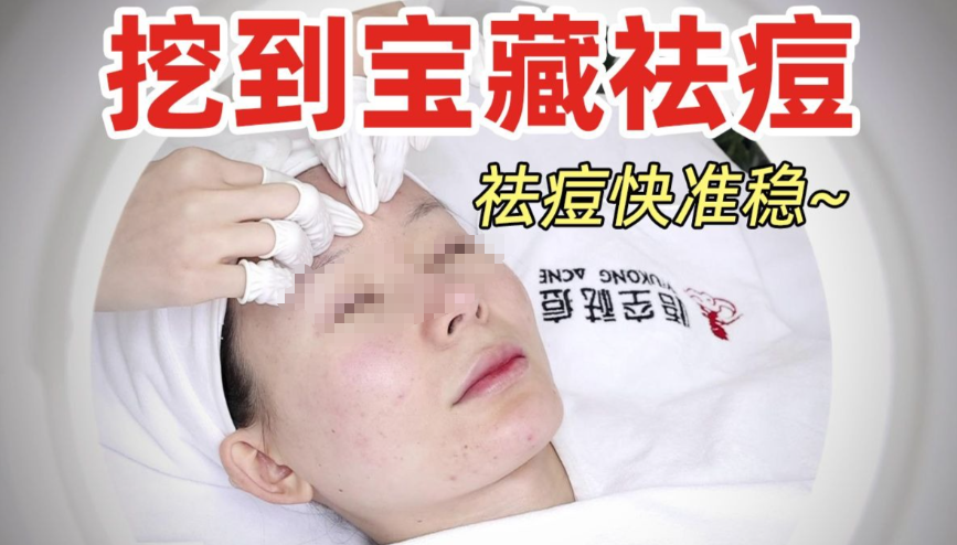 悟空祛痘有用吗？不是所有痘都适合！但我的炎性痘用了真的有疗效