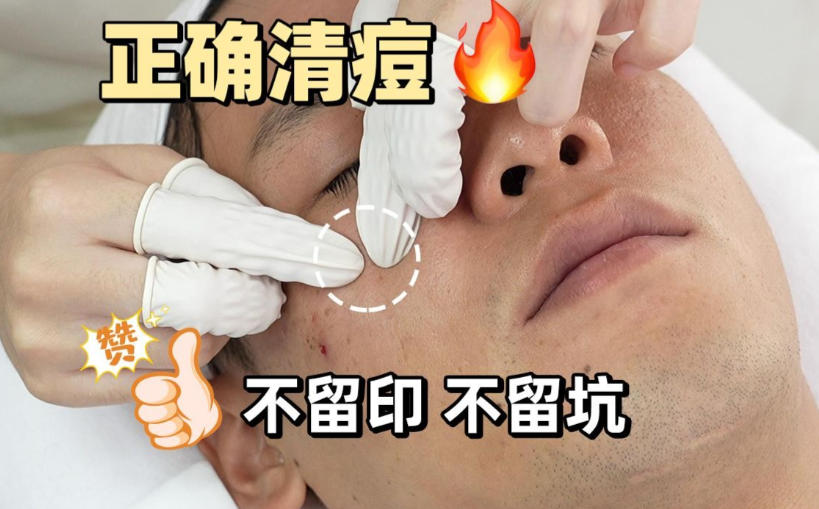 悟空祛痘机构情况如何