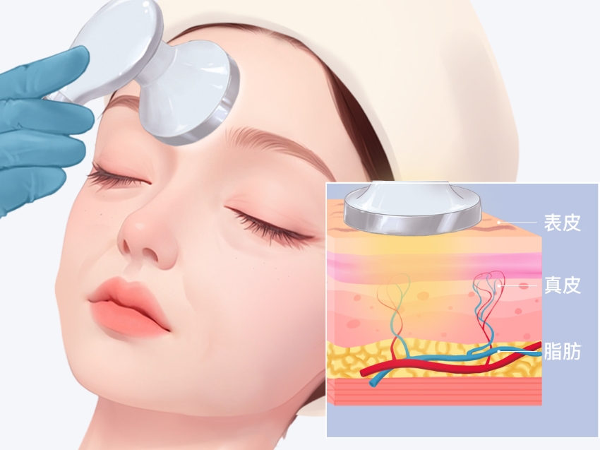 韩国清潭smin皮肤科激光美容做得好