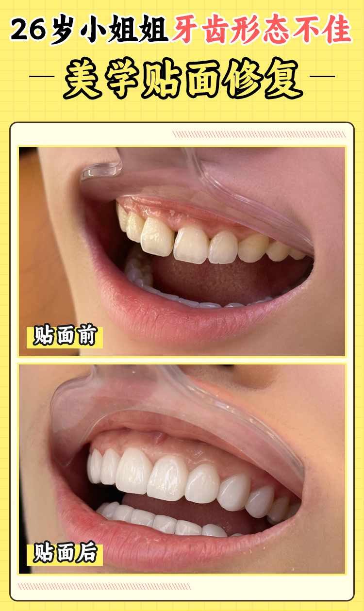 六、广州暨广口腔价格情况