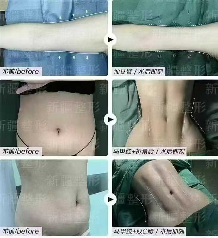 新疆威兹曼整形外科医院的热门项目有哪些？