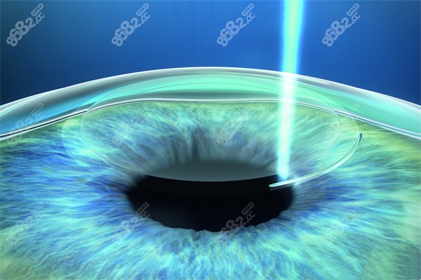 浙医二院眼科中心地铁怎么走？城站1/5号线D口，地下通道直达超省心