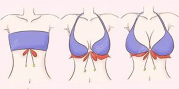 深圳市人民医院整形外科医生排名｜眼鼻/乳房/修复能手全解析，选对医生