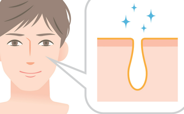 韩国缩小毛孔做什么医美项目好？水光注射、黄金微针等了解一下