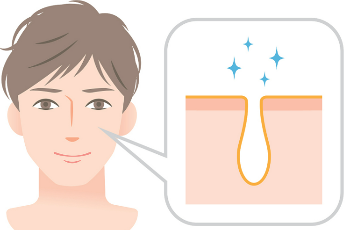 韩国缩小毛孔做什么医美项目好?水光注射、黄金微针等了解一下