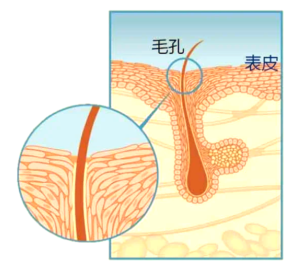 韩国缩小毛孔项目有什么风险与禁忌?