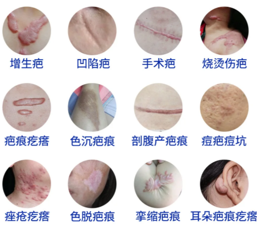 苏映军祛疤医生在哪个医院？他就在西安国医整形坐诊，挂号攻略看这里