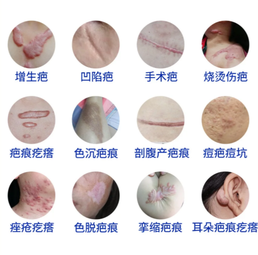   
苏映军和苏雪峰祛疤哪个腻害？2025技术测评：两人专攻方向完全不同