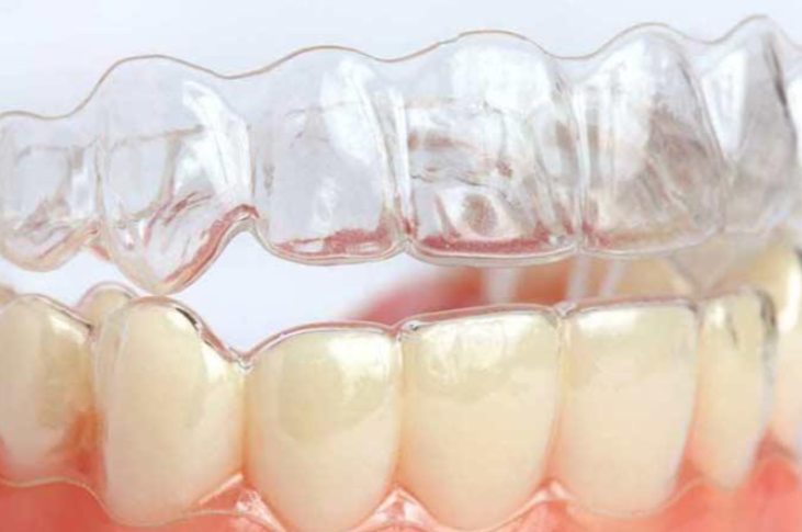 周相宏在正畸圈口碑怎么样？2000+患者用隐形、金属正畸体验给出答案