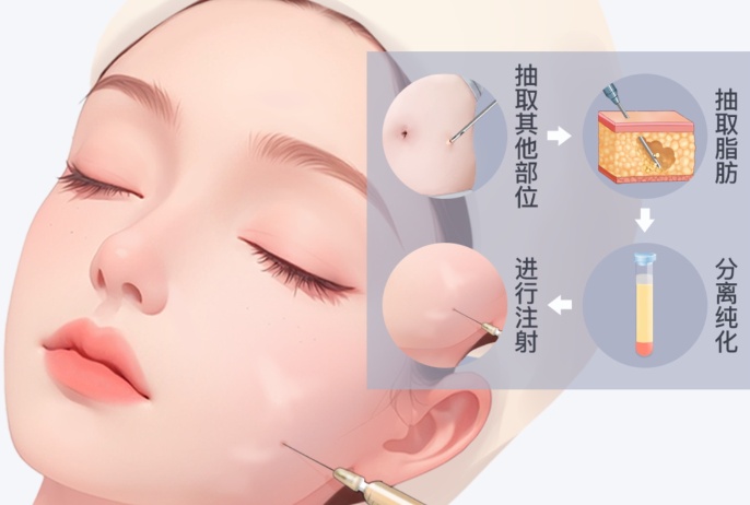 皮贴骨项目的主要风险与副作用有哪些?