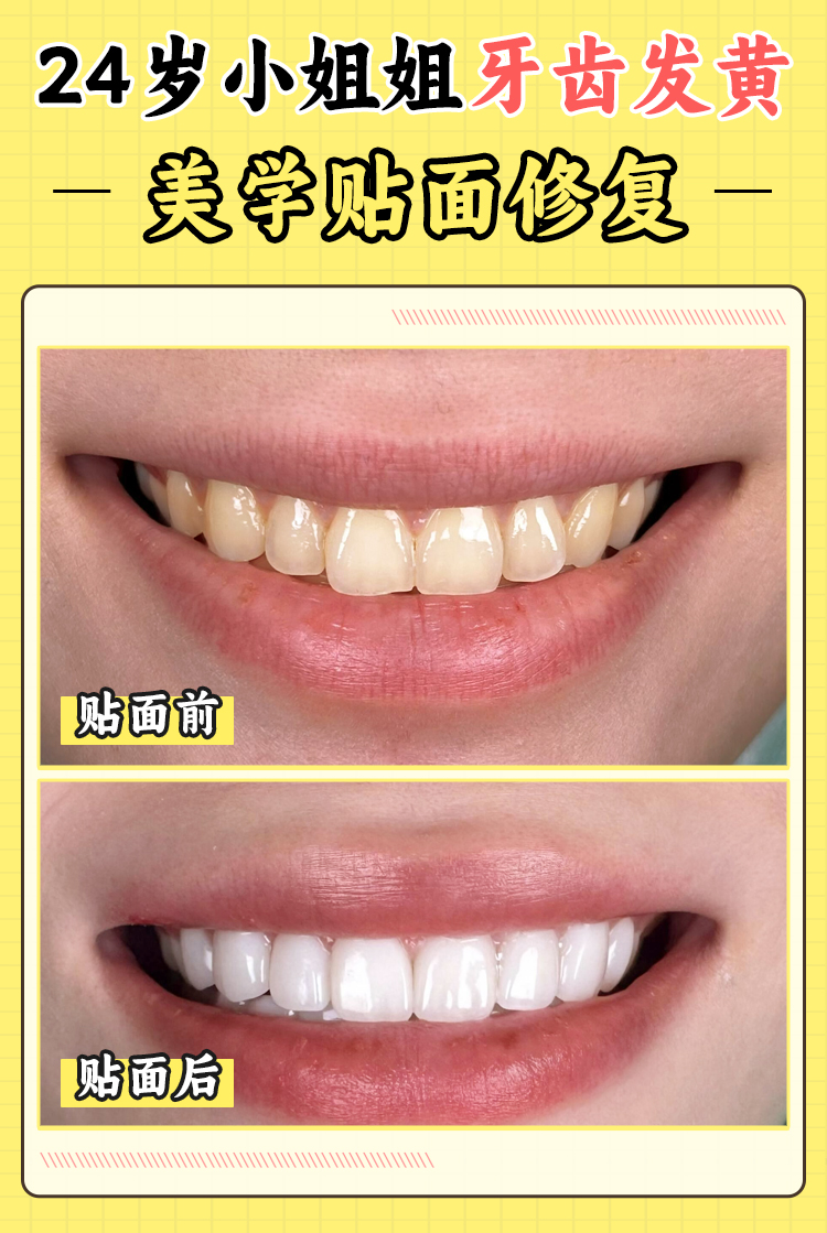 五、沈阳中幸口腔医院的价格优势