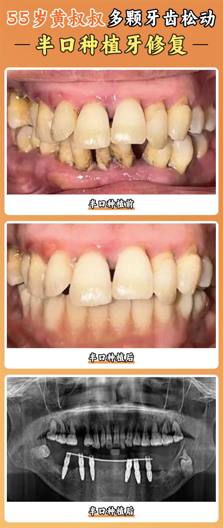 一、徐州美奥口腔医院是几级医院——答案揭晓