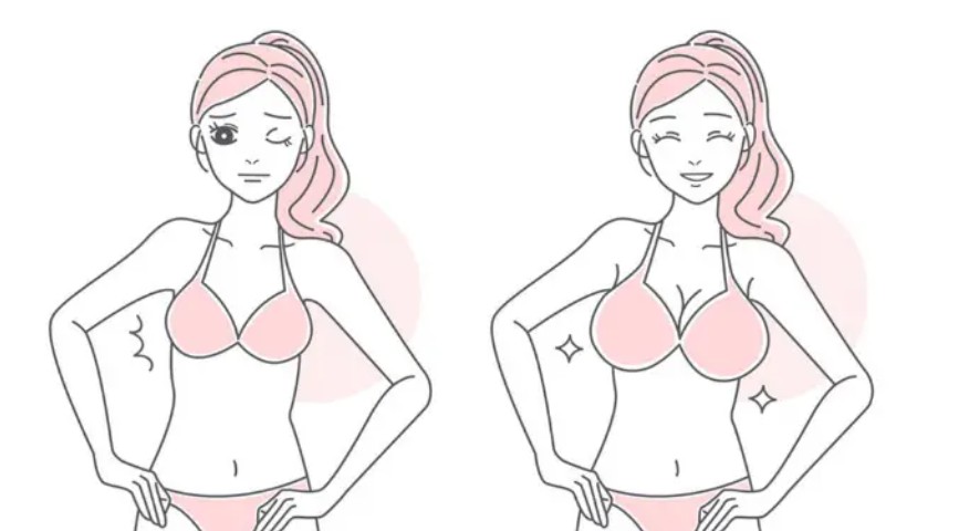 曾立医生是广州丰胸更腻害的医生吗？对比唐志荣、鲁峰的技术后答案揭晓