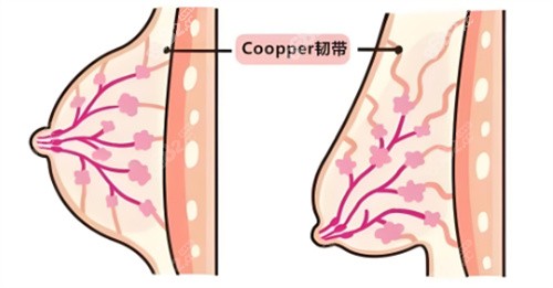乳房下垂韌帶組織對比