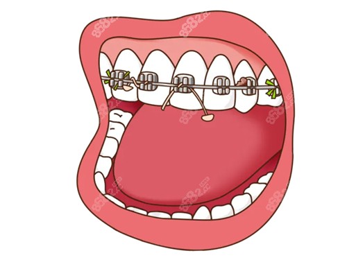 保护牙齿重要性