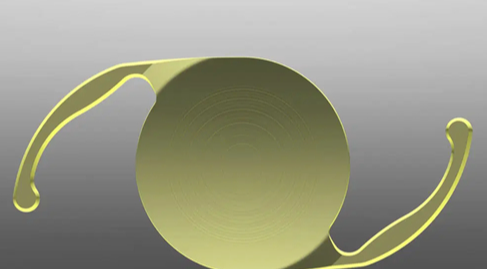 爱尔康dft015晶体优点与局限