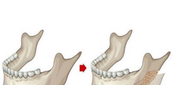 楊君毅在上海港華的坐診情況？地址、預(yù)約方式及門診特點(diǎn)