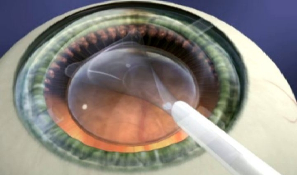 眼科医生吴众坐诊时间www.8682.cc